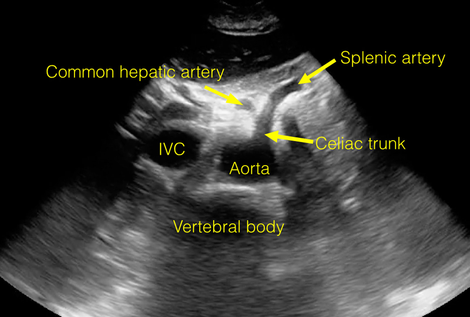 Emergency Ultrasound Cases | NYU Langone Health