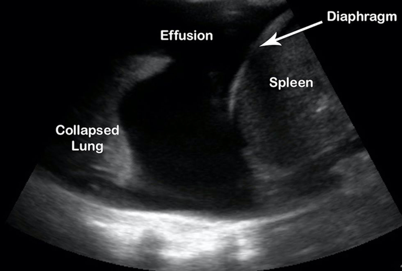 curvilinear probe ultrasound pediatric