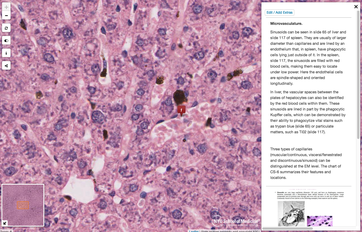 NYU Virtual Microscope Shows Microvasculature