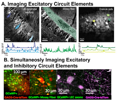 Graphic Showing One-Photon In Vivo Widefield Imaging and Large-Scale Electrophysiology in Head-Fixed Mice During Awake, Restful, and Sleep-States