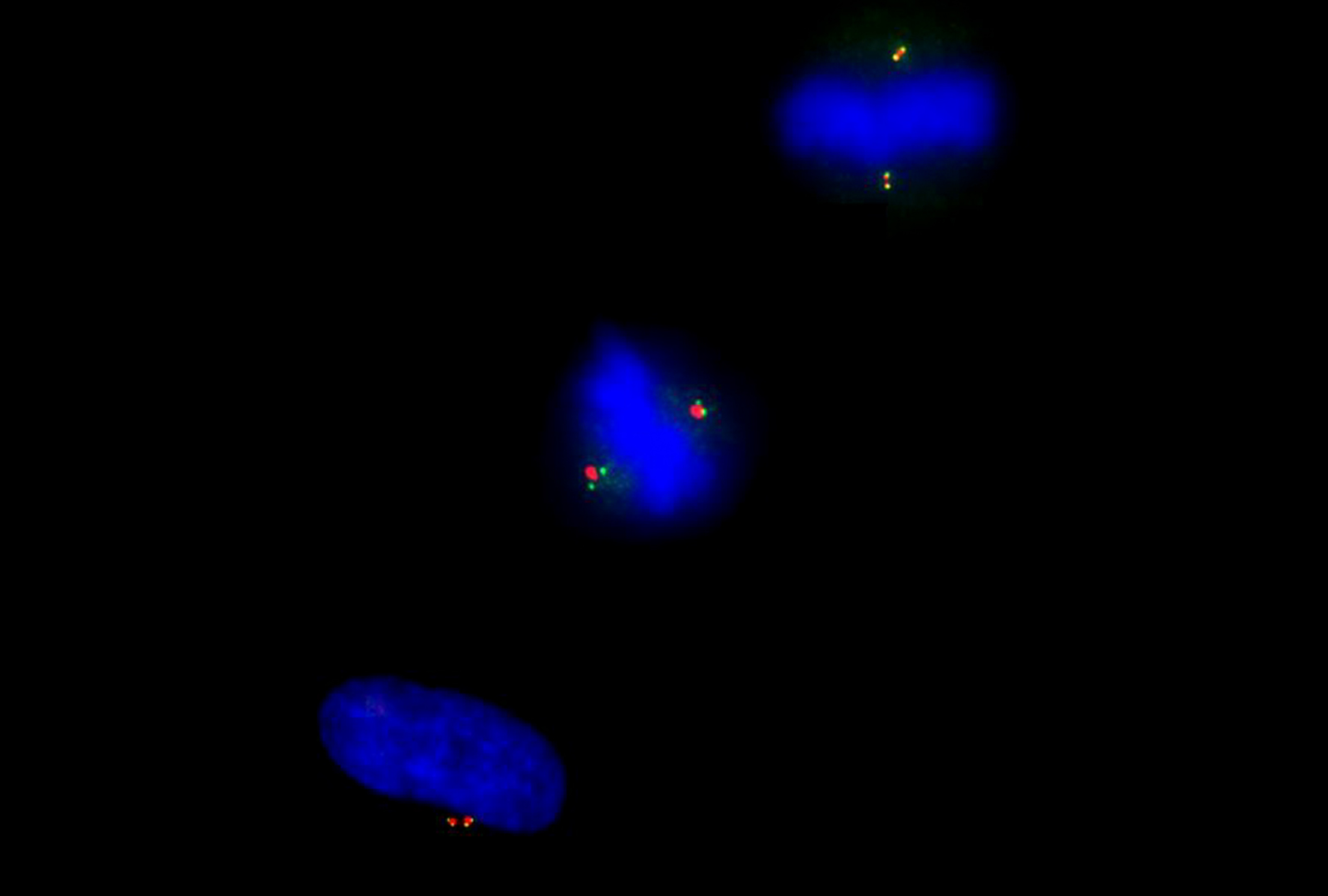 Microscopic Image of the CP110 Protein