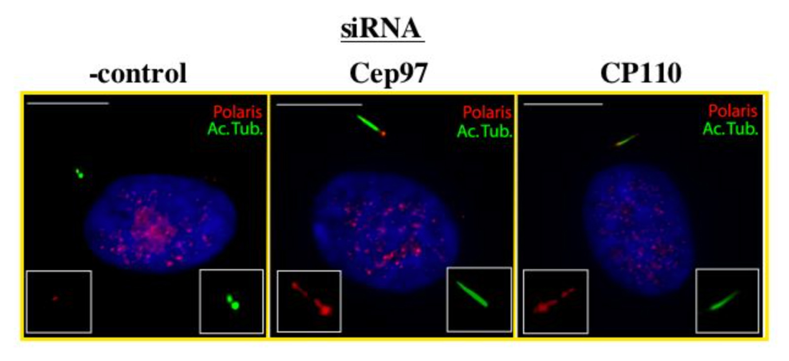 Microscopic Image Showing Cep97 and CP110 Working Together to Inhibit Assembly of Primary Cilia in Growing Cells