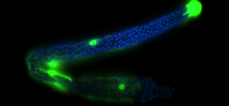 C. Elegans Germ Line Highlighted to Show Distal-Most Pair of Sheath Cells