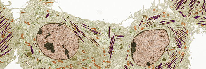 Microscopic Image of Bone Cells