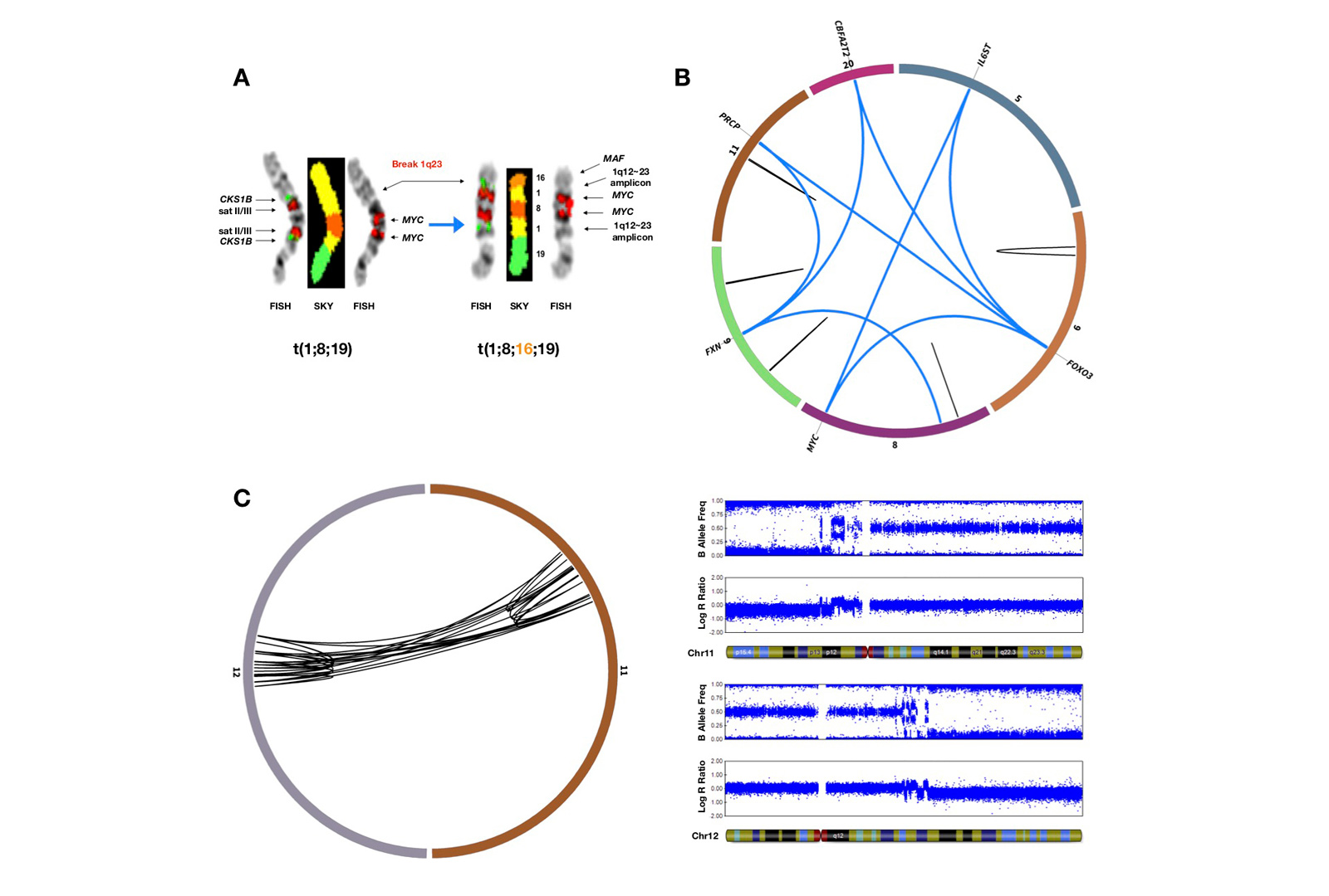 Four Representations of the Impact of Complex Structural Variants on the Epigenetic Control of Gene Regulation and how it Could be Targeted in Multiple Myeloma