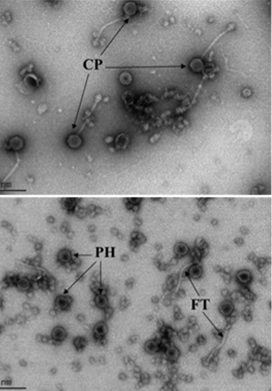 Two Microscopic Images Showing that Phage-Inducible Mobile Pathogenicity Islands of S. Aureus Can Participate in Genetic Transduction