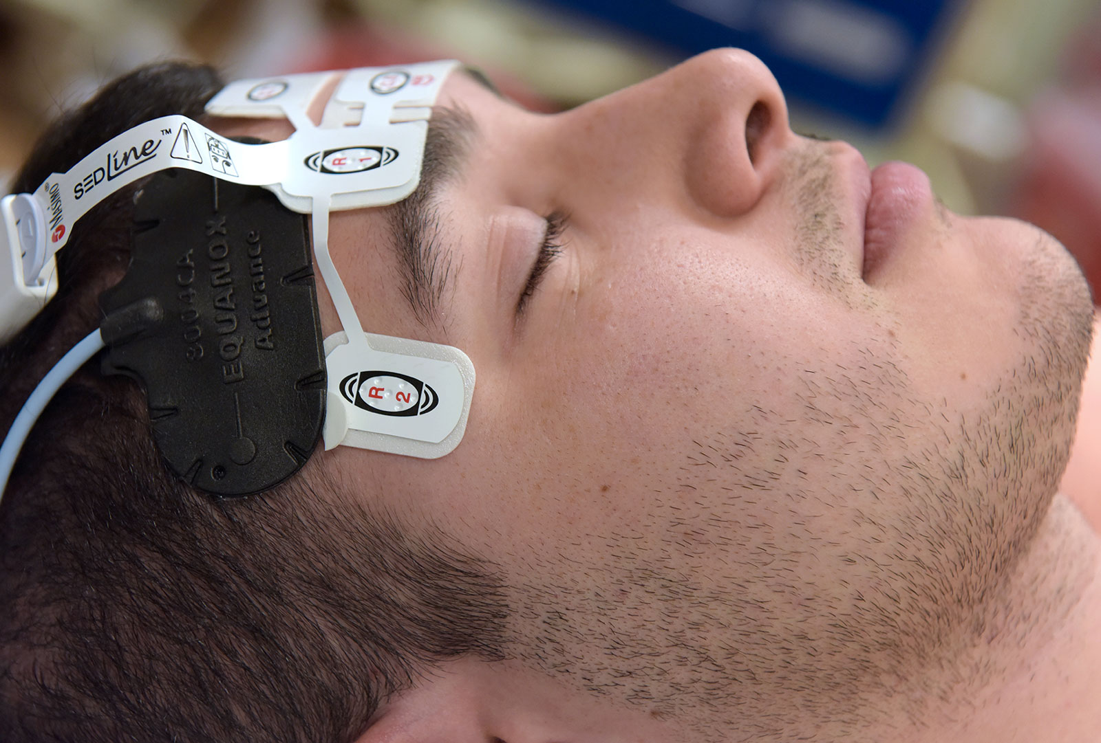 Patient Wearing Cerebral Oximetry and Electroencephalography Sensors on Forehead