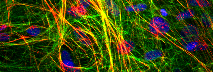 Microscopic Image of Wilt Type Mouse Aortic Smooth Muscle Cells