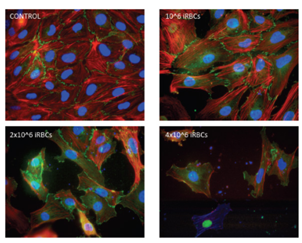 Human Brain Microvascular Endothelial Cells at Different Ratios of Plasmodium falciparum Infection