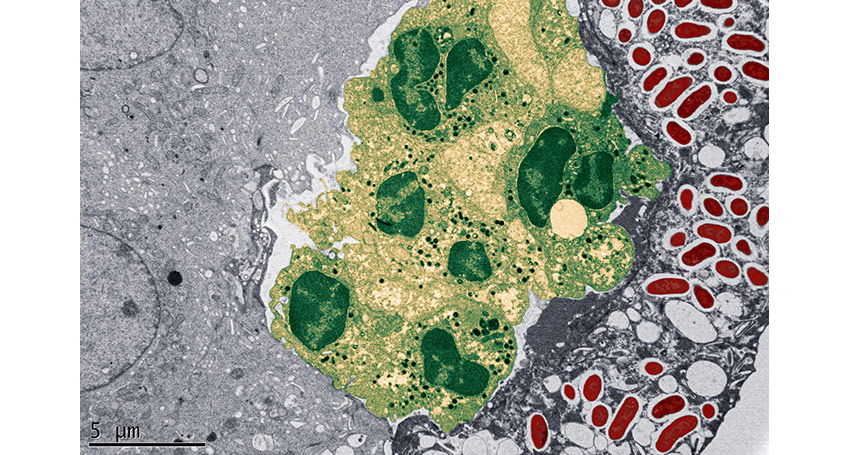 Image of Neutrophil Preventing Bacterial infection