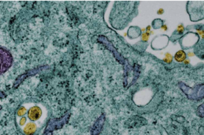 Electron Microscopy Image