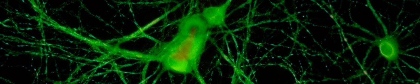 Microscopic Image of Neurons