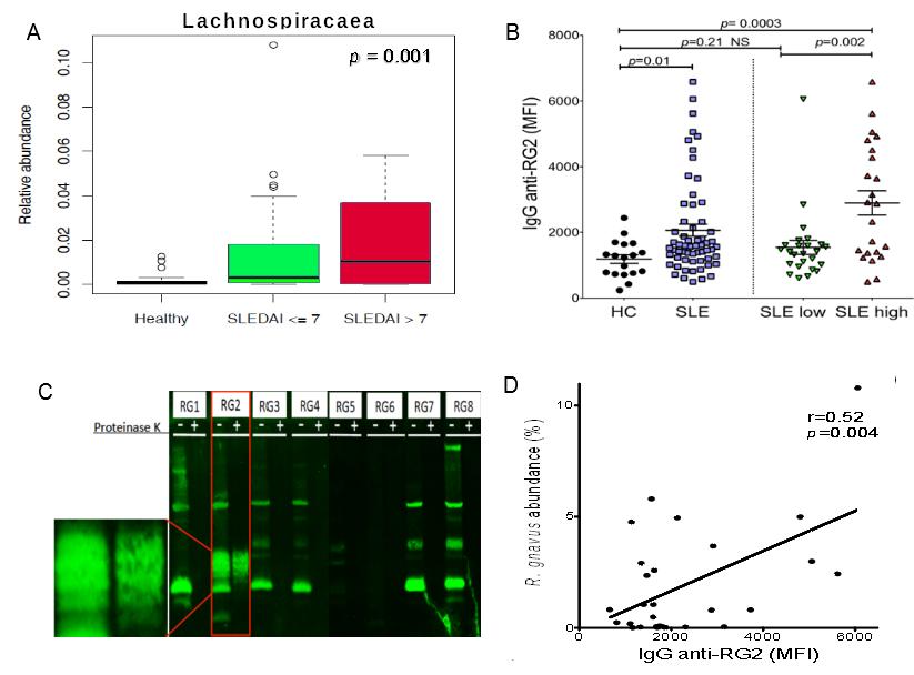 Grid of Four Graphs Showing that Patients With Systemic Lupus Erythematosus Displayed Decreased Richness or Diversity in their Microbiome Community