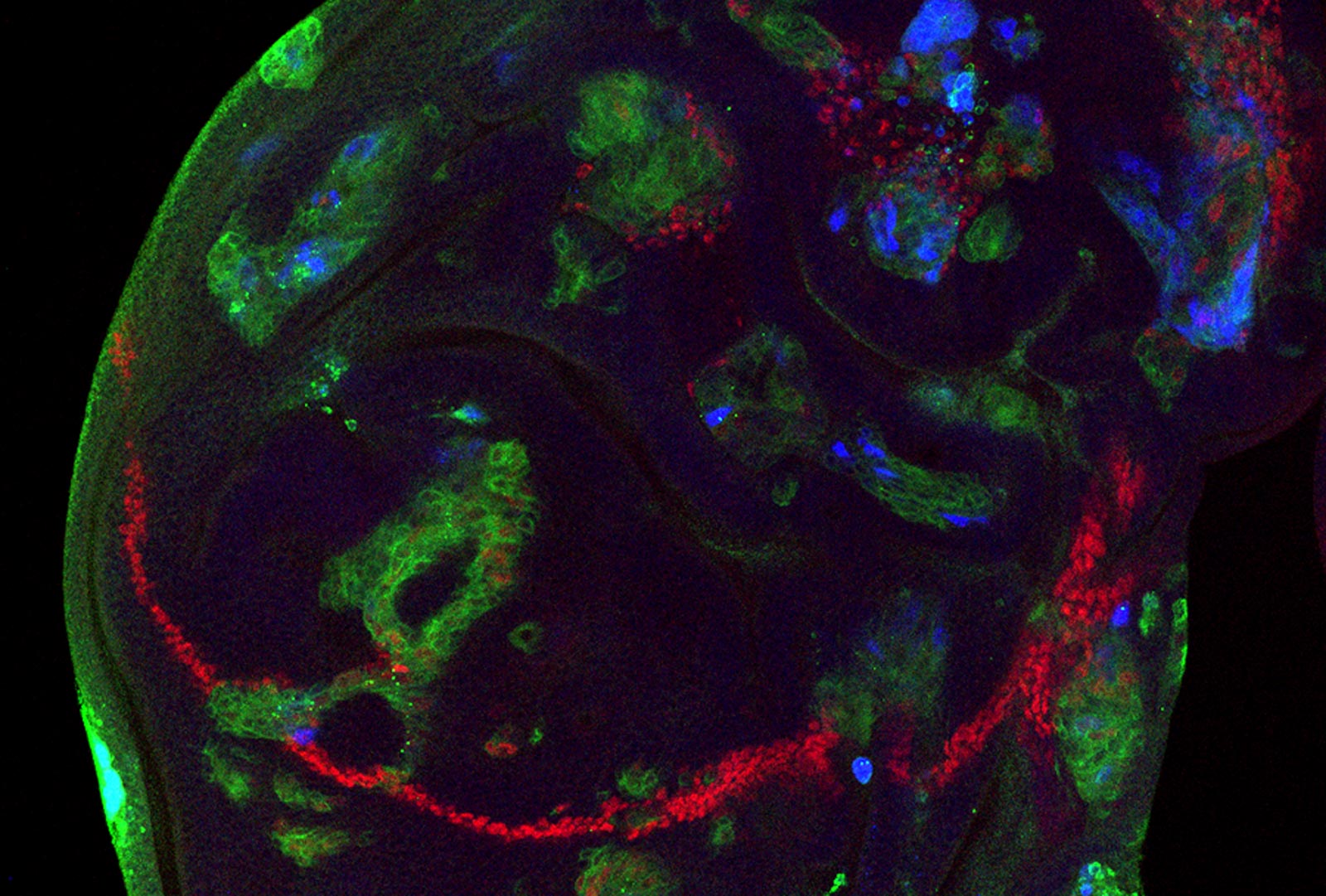 Wing Disc of Drosophila Stained to Show Misexpression of Glass and Activated Ras