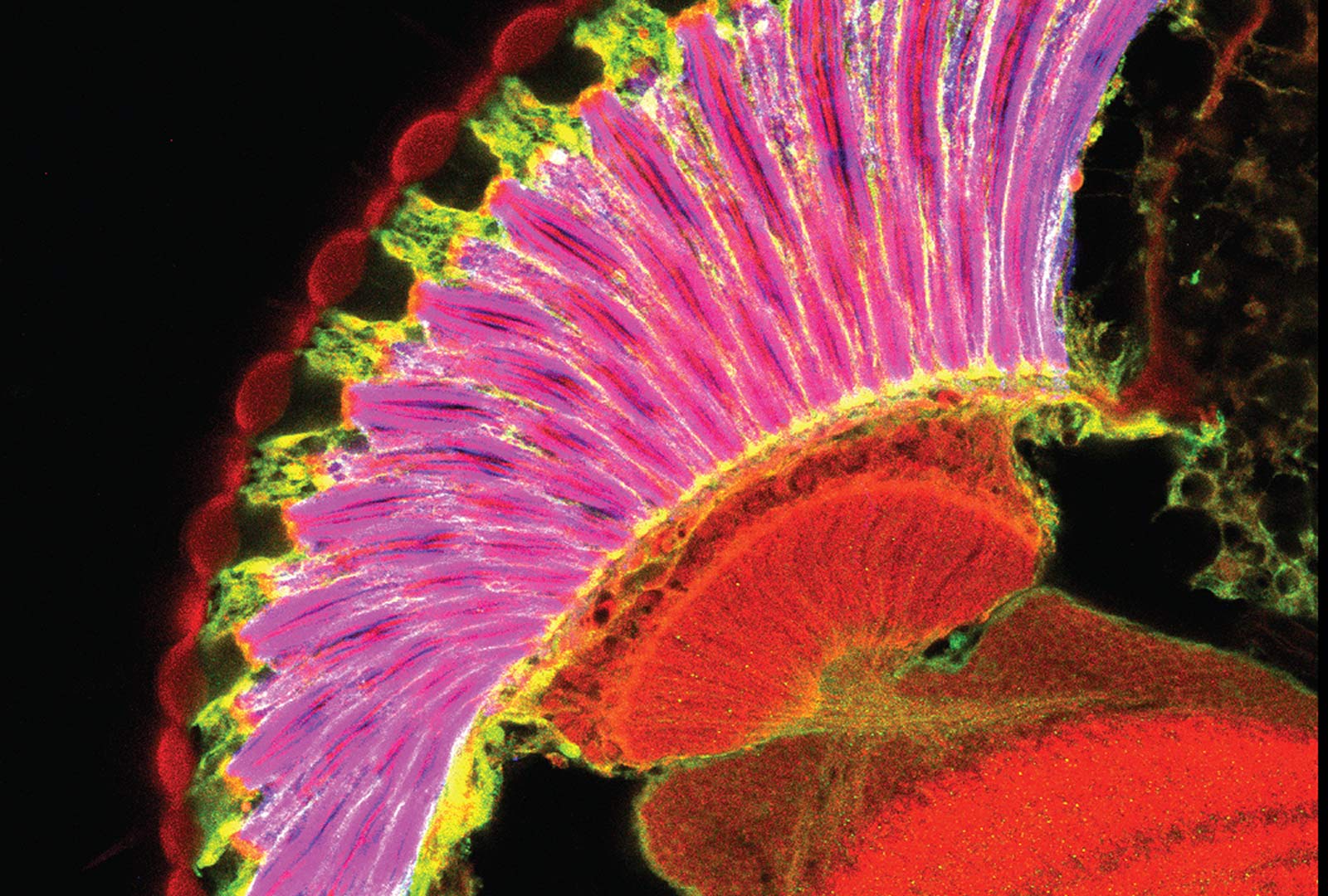 Section of an Adult Eye Stained to Show Corneal Lenses, Pigment Cells, and Photoreceptors