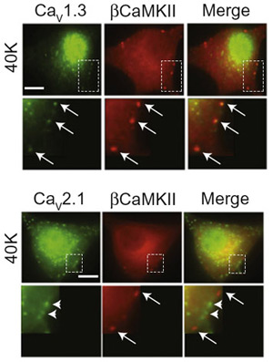 Grid of 12 Synaptic Images Showing that Voltage-Dependent-Gated Cav1 Channels Use the Ca2+ Nanodomain to Drive Local CaMKII Aggregation and Trigger Communication with the Nucleus