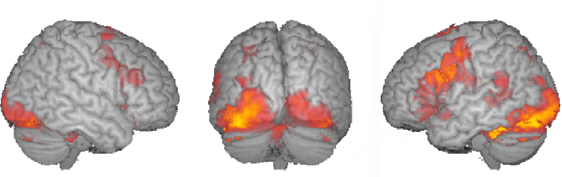 Functional Magnetic Resonance Imaging (fMRI) | NYU Cognitive  Neurophysiology Laboratory