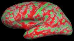 Figure 4: Cortical thickness map across the whole brain (red indicates larger thickness values)